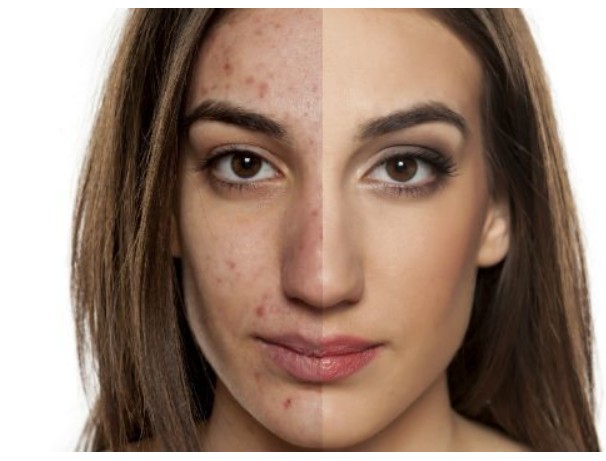 skin cancer treatment Irvine CA